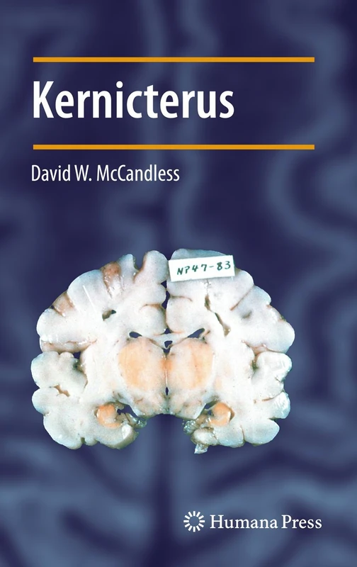 Kernicterus (Contemporary Clinical Neuroscience) - Image 1