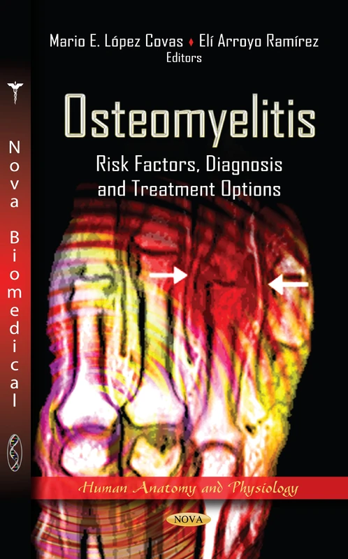 Osteomyelitis: Risk Factors, Diagnosis & Treatment Options (Human Anatomy & Physiology Series) (Human Anatomy and Physiology: Bacteriology Research Developments)