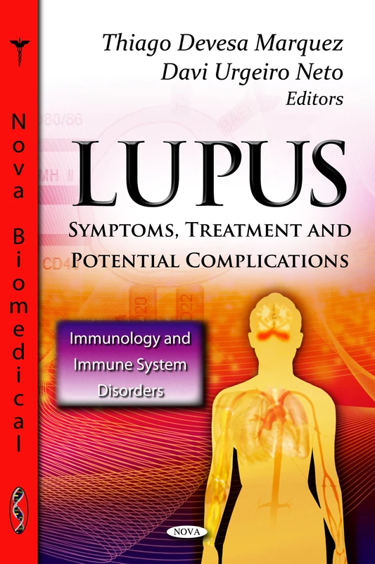 Lupus: Symptoms, Treatment & Potential Complications (Immunology & Immune System Disorders Series) (Immunology and Immune System Disorders)