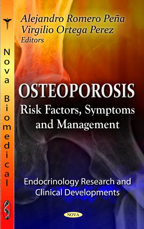 OSTEOPOROSIS: Risk Factors, Symptoms & Management (Endocrinology Research and Clinical Developments: Aging Issues, Health and Financial Alternatives)