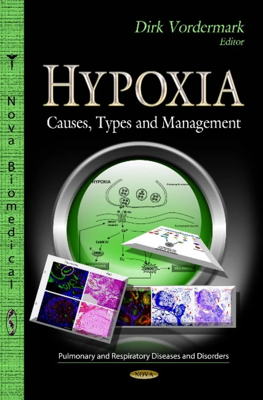 HYPOXIA: Causes, Types & Management (Pulmonary and Respiratory Diseases and Disorders)