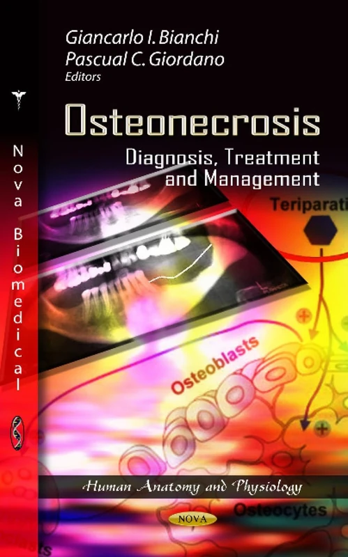 OSTEONECROSIS DIAGNOSIS TREAT.: Diagnosis, Treatment & Management (Human Anatomy and Physiology: Muscular System - Anatomy, Functions and Injuries)