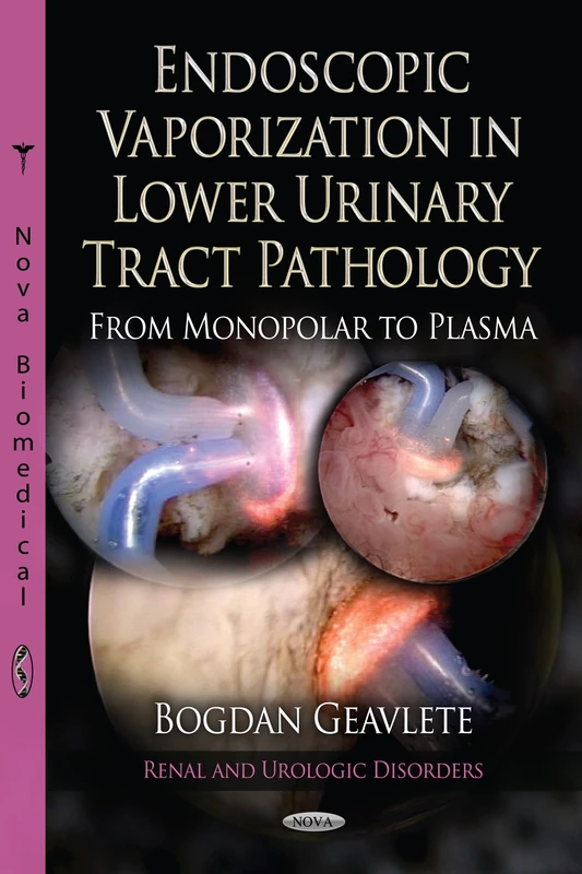 ENDOSCOPIC VAPORIZATION IN LOW (Renal and Urologic Disorders)
