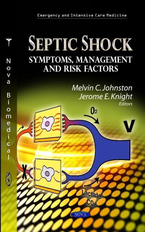 SEPTIC SHOCK SYMPTOMS MANAGEM.: Symptoms, Management & Risk Factors (Emergency and Intensive Care Medicine)