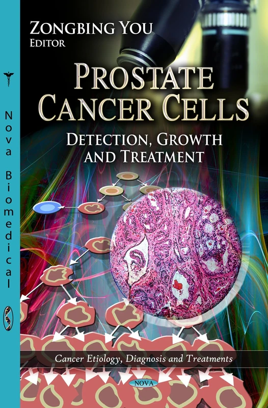 PROSTATE CANCER CELLS: Detection, Growth & Treatment (Cancer Etiology, Diagnosis and Treatments)