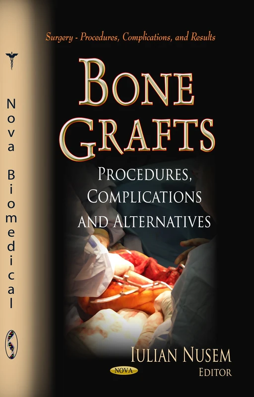 Bone Grafts Procedures, Complications & Alternatives Book