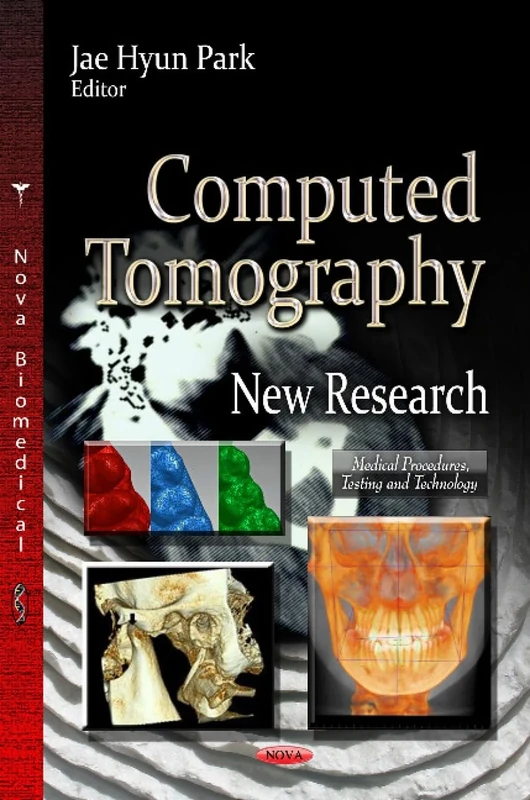 COMPUTED TOMOGRAPHY NEW RES.: New Research (Medical Procedures, Testing and Technology)
