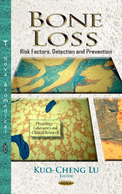 BONE LOSS RISK FACTORS DETECT.: Risk Factors, Detection & Prevention (Physiology - Laboratory and Clinical Research)