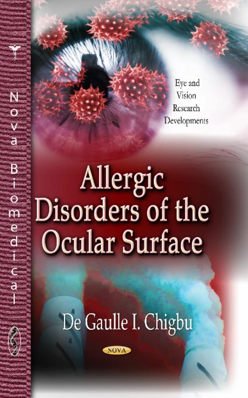 ALLERGIC DISORDERS OF OCULAR (Eye and Vision Research Developments)
