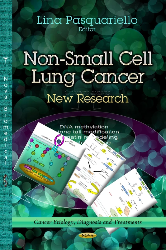 Non-Small Cell Lung Cancer: New Research (Cancer Etiology, Diagnosis and Treatments)