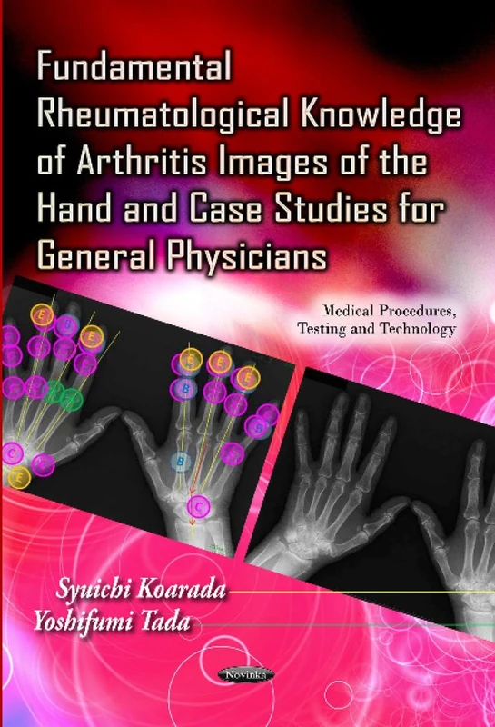 Fundamental Rheumatological Hand Radiography Medical Guide