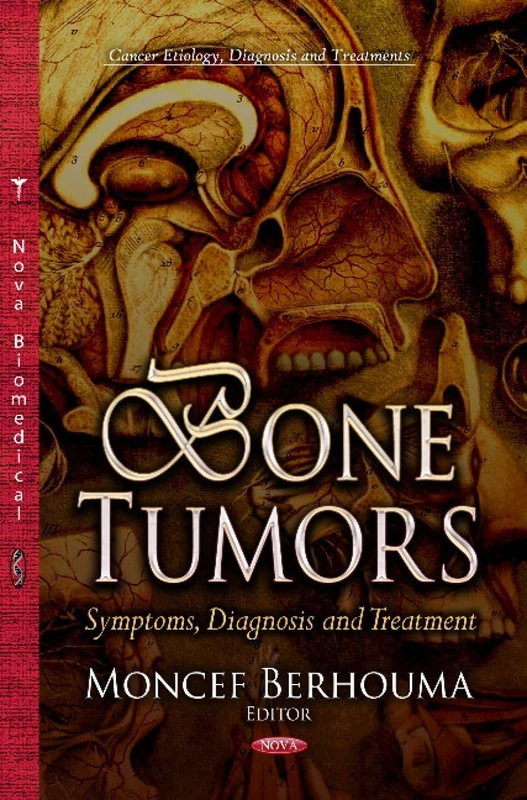 BONE TUMORS SYMPTOMS DIAGNOSIS: Symptoms, Diagnosis & Treatment (Cancer Etiology, Diagnosis and Treatments)