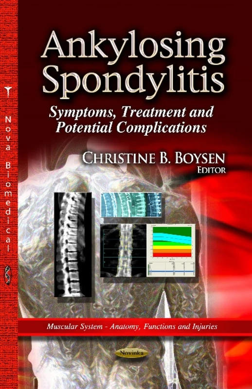 Ankylosing Spondylitis: Symptoms, Treatment & Potential Complications (Muscular System - Anatomy, Functions and Injuries)