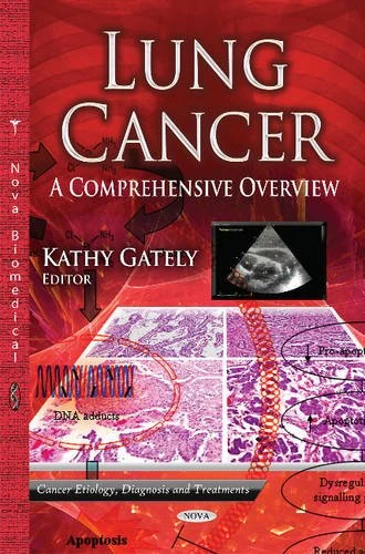 Lung Cancer: A Comprehensive Overview (Cancer Etiology, Diagnosis and Treatments)