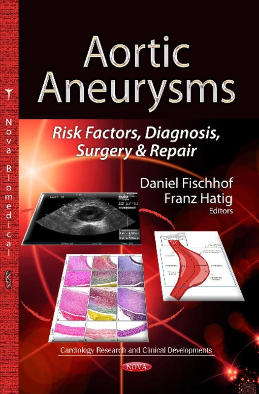 Aortic Aneurysms: Risk Factors, Diagnosis, Surgery & Repair (Cardiology Research and Clinical Developments: Surgery-procedures, Complications, and Results)