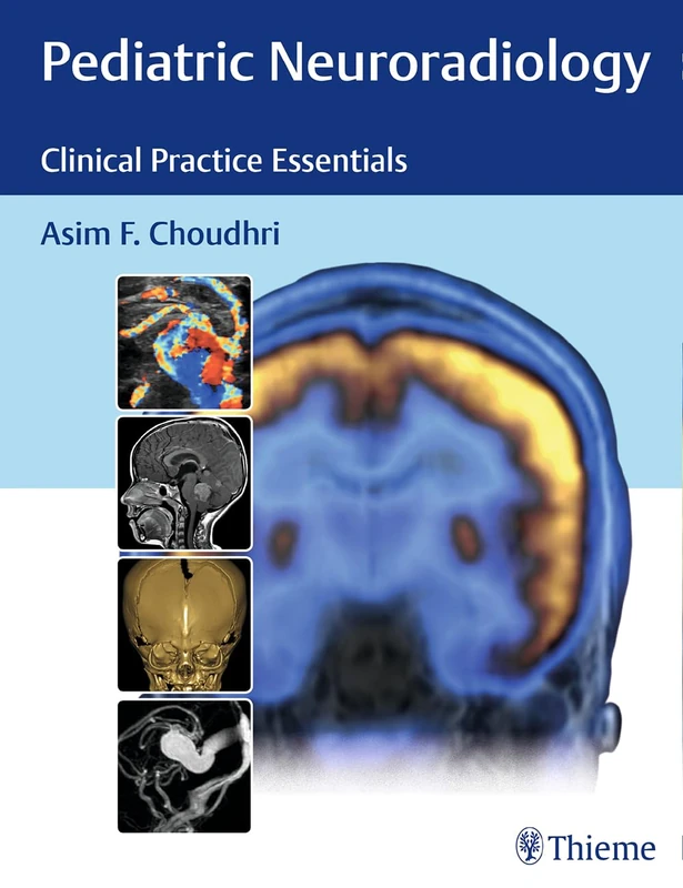 Pediatric Neuroradiology: The Essentials: Clinical Practice Essentials