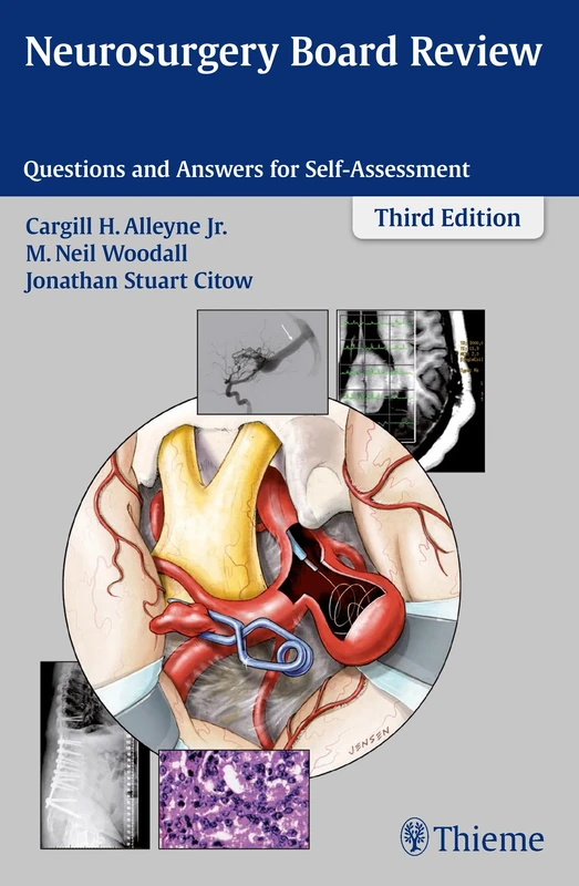 Neurosurgery Board Review: Questions and Answers for Self-Assessment