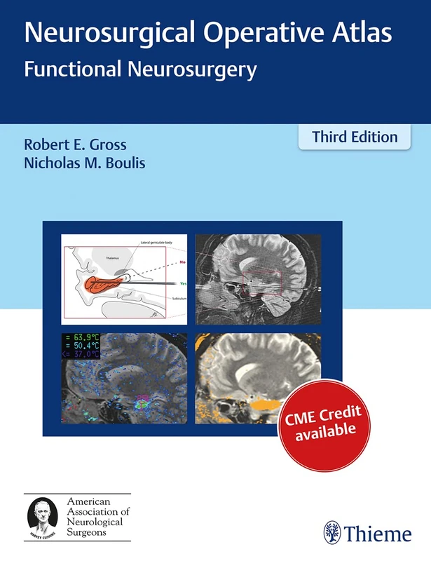 Neurosurgical Operative Atlas: Functional Neurosurgery - Image 1