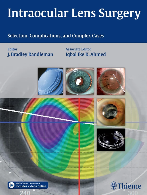 Thieme Intraocular Lens Surgery - Selection and Complex Cases