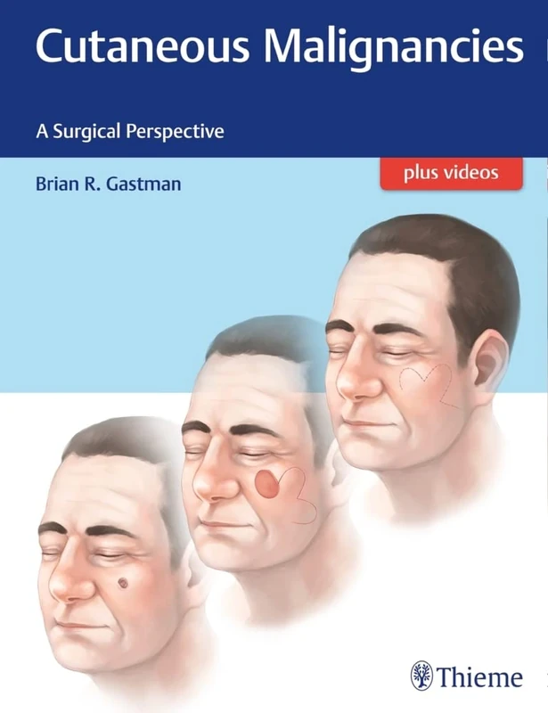 Thieme Cutaneous Malignancies: A Surgical Perspective Book