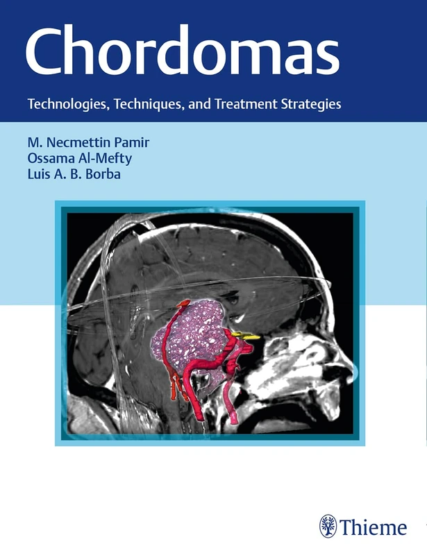 Thieme Chordomas: Technologies, Techniques, and Treatment