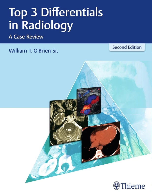 Top 3 Differentials in Radiology: A Case Review