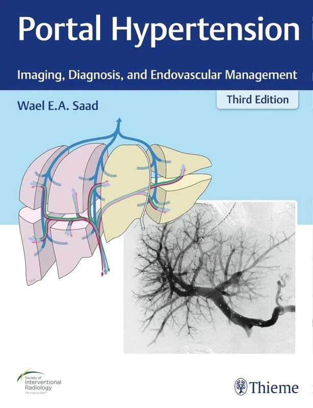 Portal Hypertension: Imaging, Diagnosis, and Endovascular Management