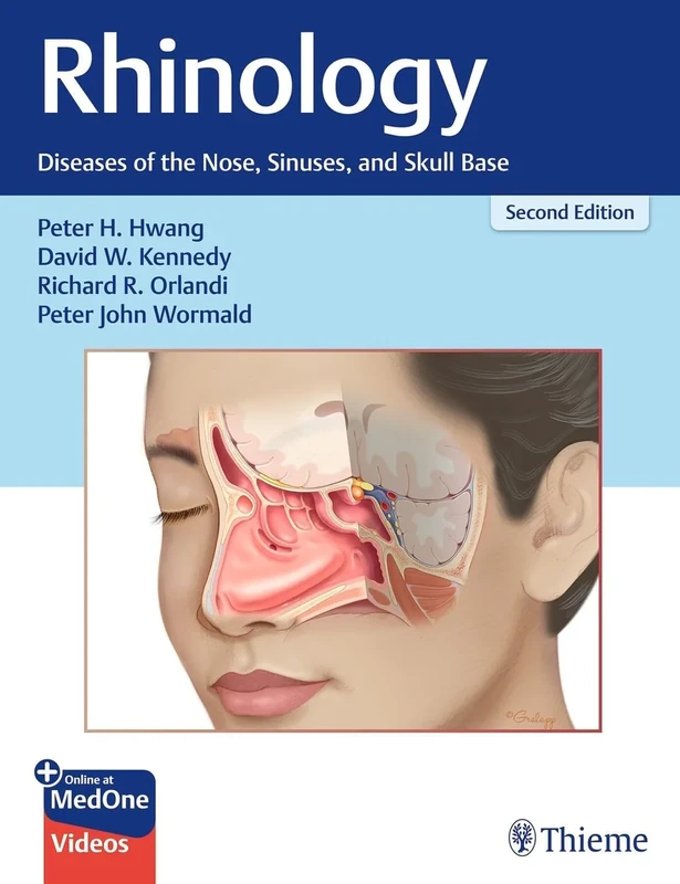 Rhinology: Diseases of the Nose, Sinuses, and Skull Base