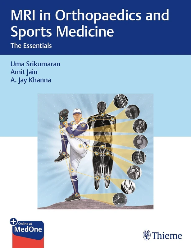 Thieme MRI in Orthopaedics and Sports Medicine: The Essentials