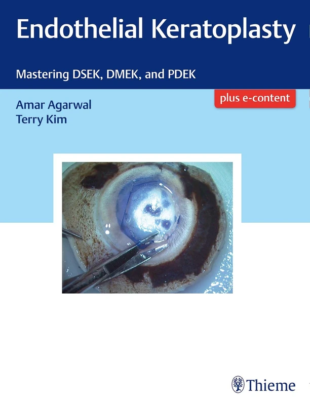 Endothelial Keratoplasty: Mastering DSEK, DMEK, and PDEK