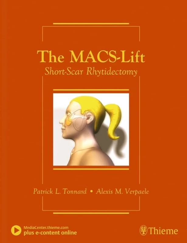 The Macs-Lift: Short-Scar Rhytidectomy