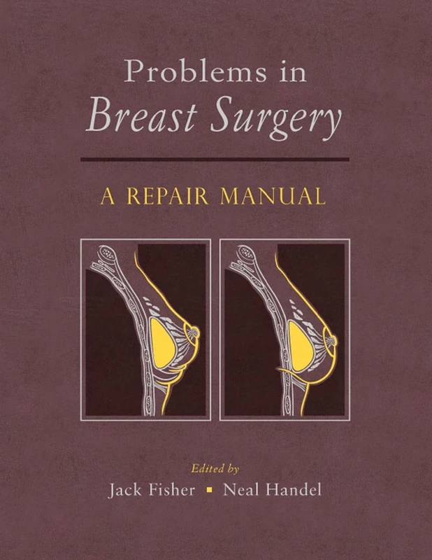 Problems in Breast Surgery: A Repair Manual