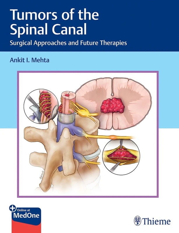 Thieme Tumors of the Spinal Canal - Surgical Approaches Book