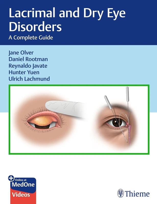 Thieme Lacrimal Surgery: Medical and Surgical Management Book