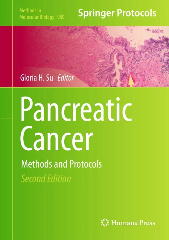 Humana Pancreatic Cancer: Methods and Protocols 980 Book