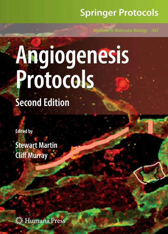 Angiogenesis Protocols: 467 (Methods in Molecular Biology, 467)