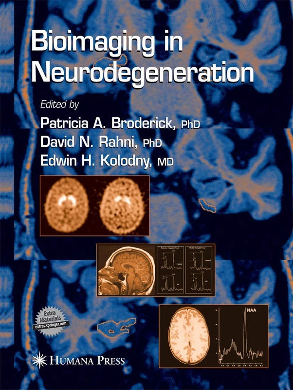 Bioimaging in Neurodegeneration (Contemporary Neuroscience)