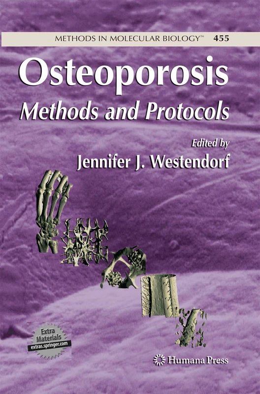 Osteoporosis: Methods and Protocols: 455 (Methods in Molecular Biology, 455) - Image 1