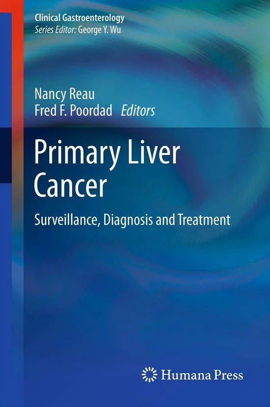 Humana Primary Liver Cancer - Surveillance, Diagnosis and Treatment
