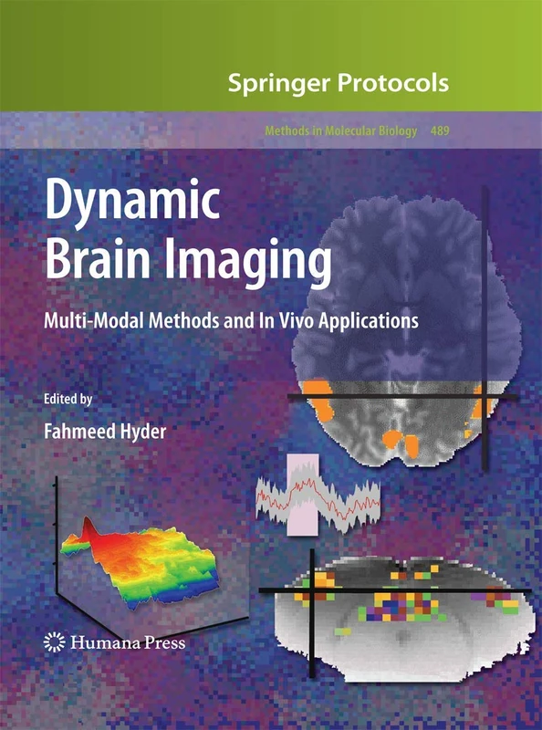 Humana Dynamic Brain Imaging: Multi-Modal Methods and Applications