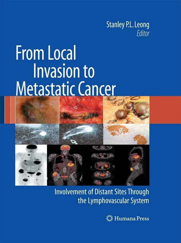 From Local Invasion to Metastatic Cancer: Involvement of Distant Sites Through the Lymphovascular System (Current Clinical Oncology)
