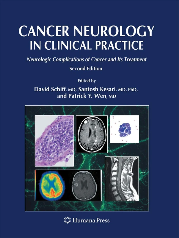 Humana Cancer Neurology in Clinical Practice Medical Book
