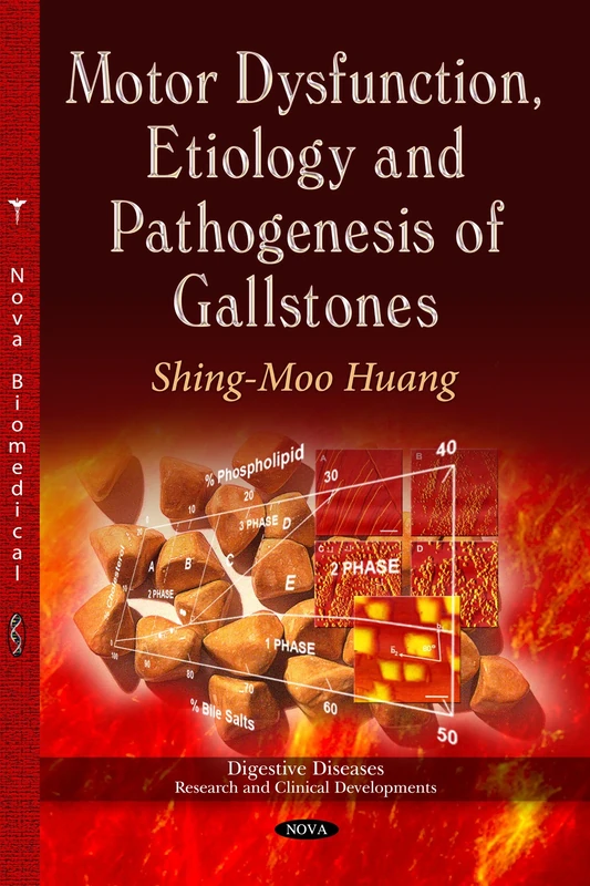 Motor Dysfunction, Etiology & Pathogenesis of Gallstones (Digestive Diseases - Research and Clinical Developments)