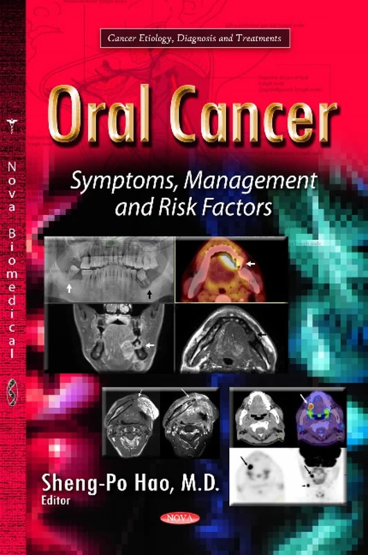 Oral Cancer: Symptoms, Management & Risk Factors (Cancer Etiology, Diagnosis and Treatments)