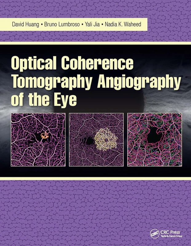 Optical Coherence Tomography Angiography of the Eye: OCT Angiography