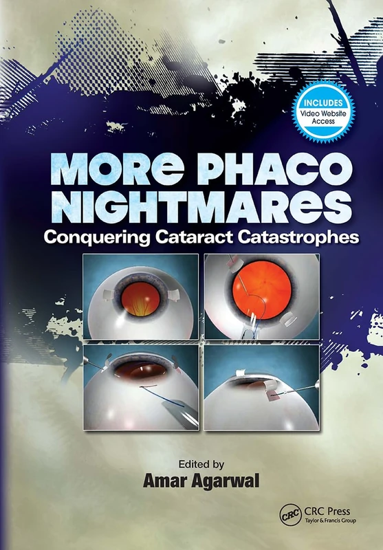 More Phaco Nightmares: Conquering Cataract Catastrophes