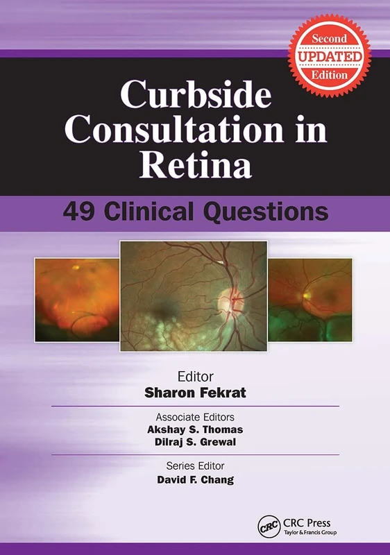 Curbside Consultation in Retina: 49 Clinical Questions (Curbside Consultation in Ophthalmology)