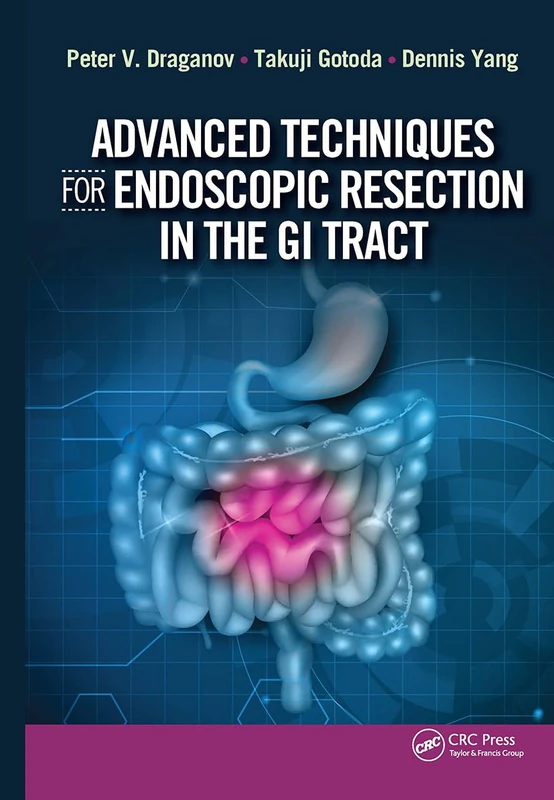 CRC Press - Advanced Techniques for Endoscopic Resection GI Tract