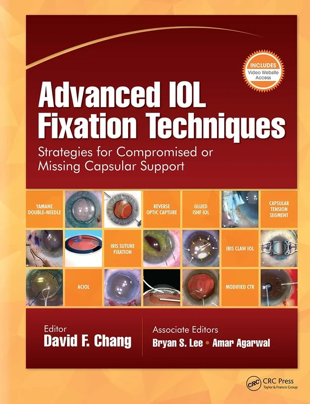 Advanced IOL Fixation Techniques: Strategies for Compromised or Missing Capsular Support