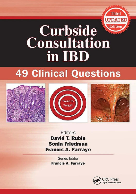 Curbside Consultation in IBD: 49 Clinical Questions (Curbside Consultation in Gastroenterology)